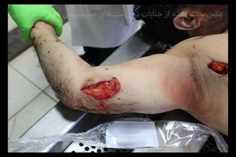 تروریست‌ها هیچ رحمی به مردم عادی نکردند