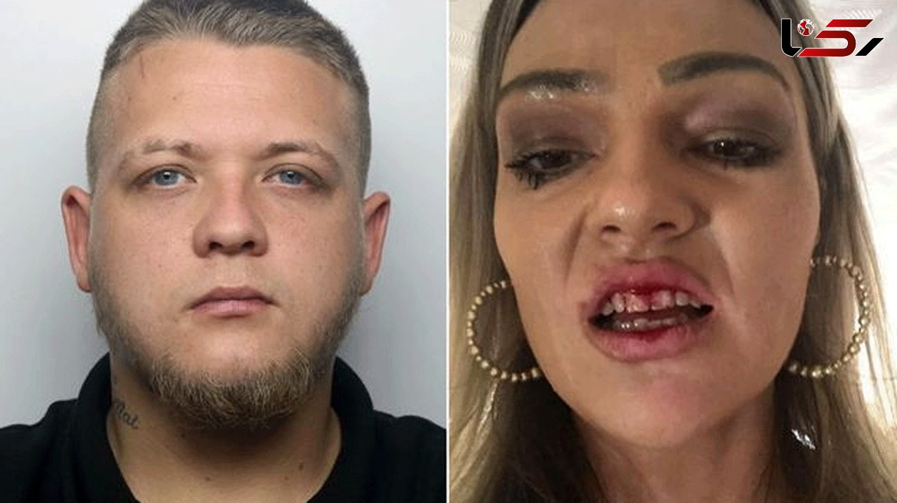 Woman shares horrific ordeal after boyfriend beat her for months during lockdown