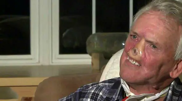 خرس صورت این پیرمرد را خورد+عکس