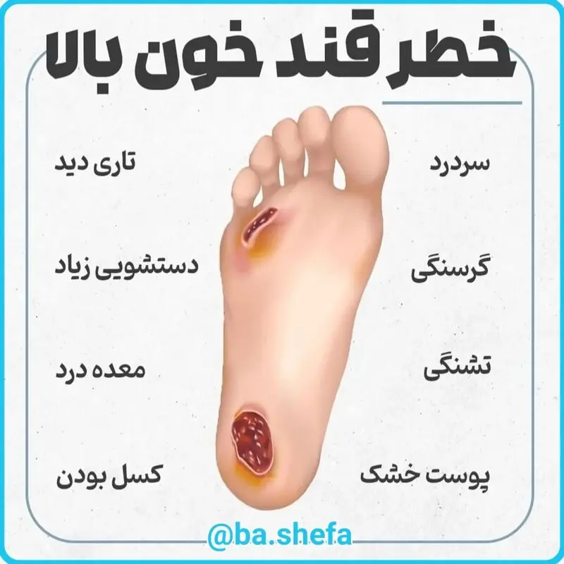 نشانه های قند خون بالا