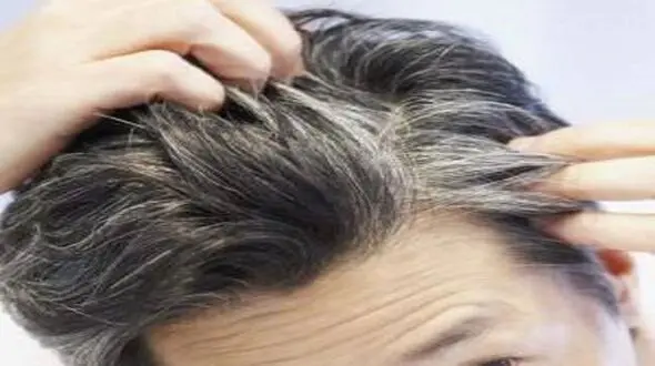 سفیدی زودرس مو با ۶ عادت رایج به سراغتان می‌آید

