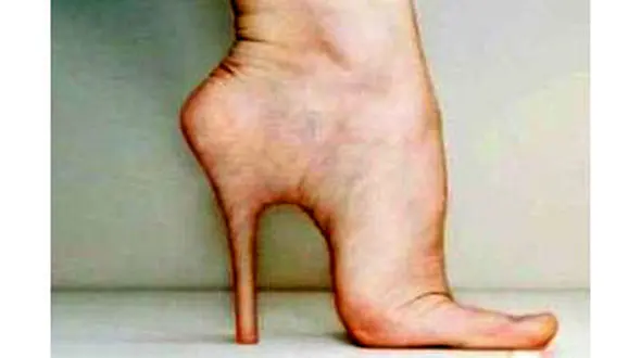 خنده دار ترین جراحی زیبایی که مد شد+عکس