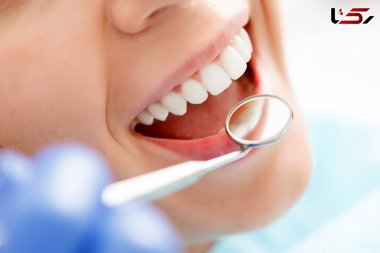هزینه انواع خدمات زیبایی دندانپزشکی شبانه روزی