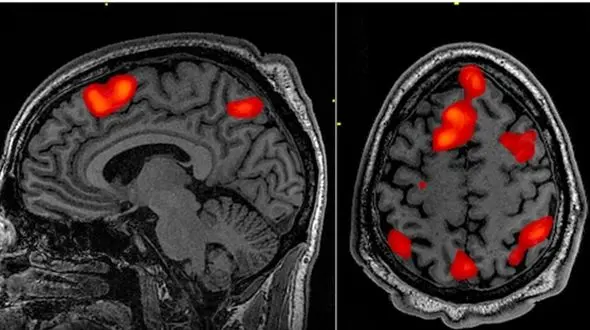 تصویربرداری مغزی با نور مادون قرمز؛ گامی انقلابی در علوم اعصاب