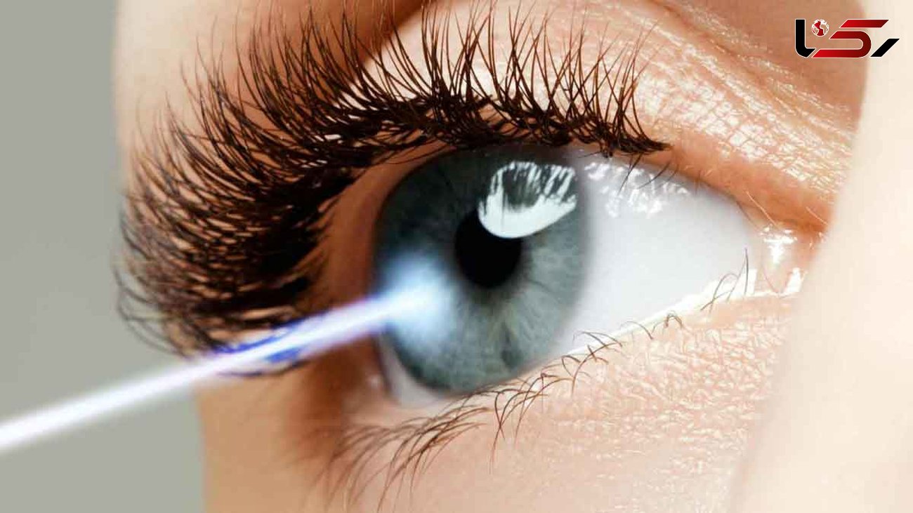 آنچه در مورد بعضی از انواع جراحی های چشم باید بدانید +هزینه