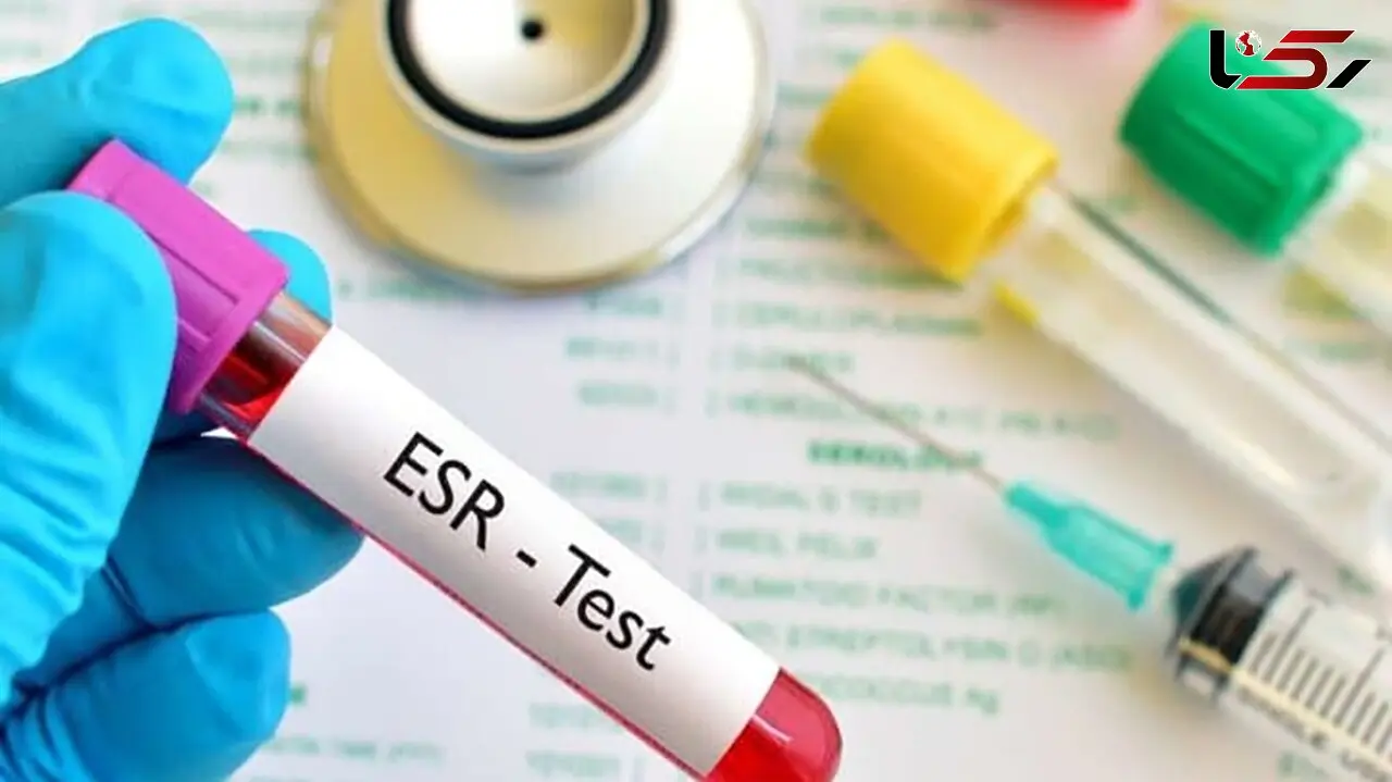 ESR چیست؟ / چه زمانی به این آزمایش نیاز دارید؟