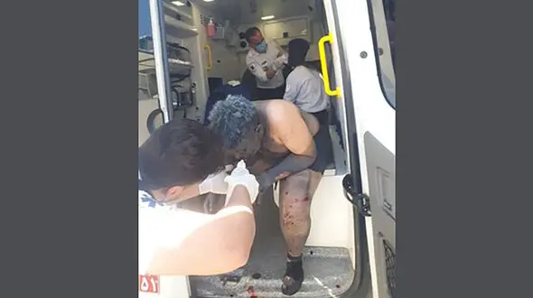 دینامیت جنگی هم وارد آتش بازی چهارشنبه سوری شد / دو جوان سنندجی مستقیم راهی بیمارستان شدند