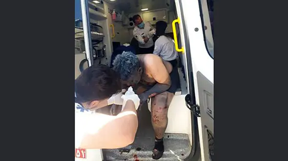 دینامیت جنگی هم وارد آتش بازی چهارشنبه سوری شد / دو جوان سنندجی مستقیم راهی بیمارستان شدند