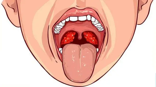 سرطان دهان چه نشانه‌هایی دارد؟