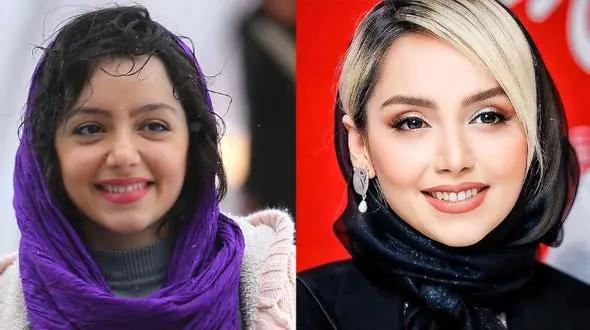 صورت نازنین بیاتی هم عملی از آب درآمد؛ لیست جراحی‌های این بازیگر لو رفت