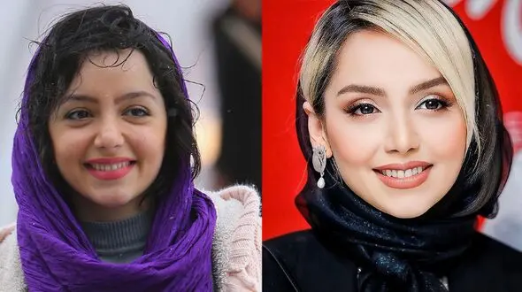 صورت نازنین بیاتی هم عملی از آب درآمد؛ لیست جراحی‌های این بازیگر لو رفت