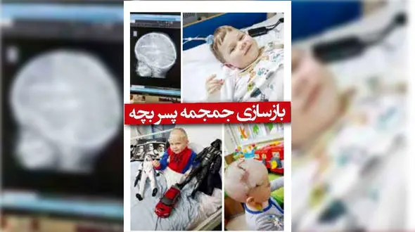  جمجمه پسر بچه بازسازی شد + عکس