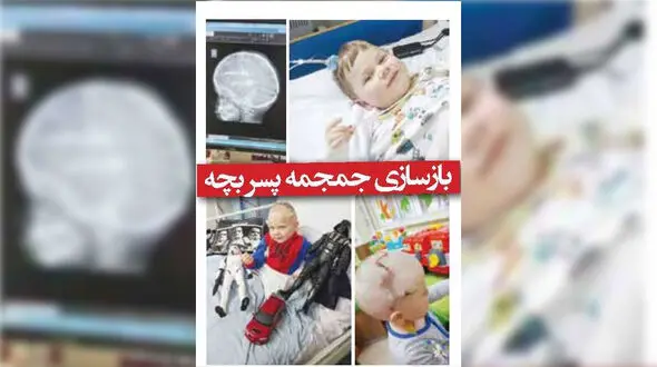  جمجمه پسر بچه بازسازی شد + عکس