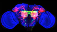 تصویربرداری از مغز برای رسیدن به درمان های نوین