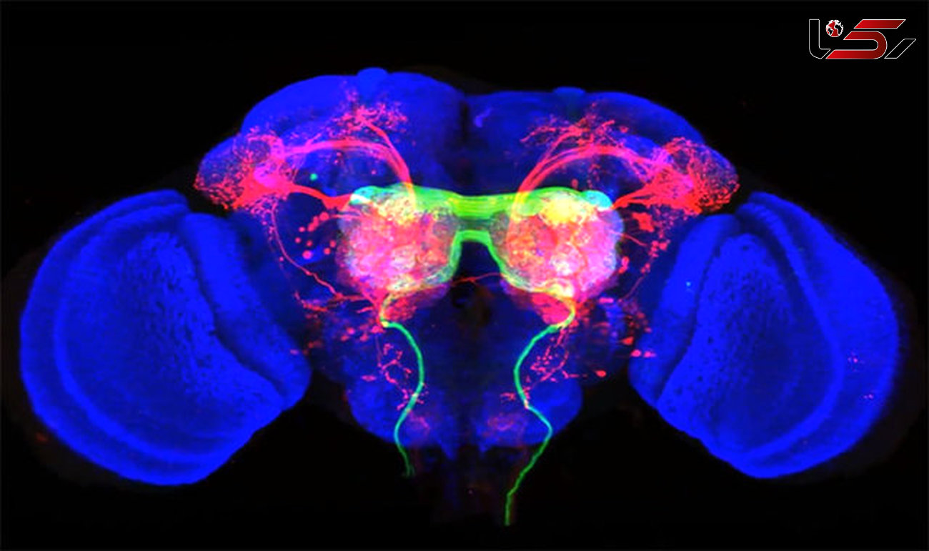 تصویربرداری از مغز برای رسیدن به درمان های نوین