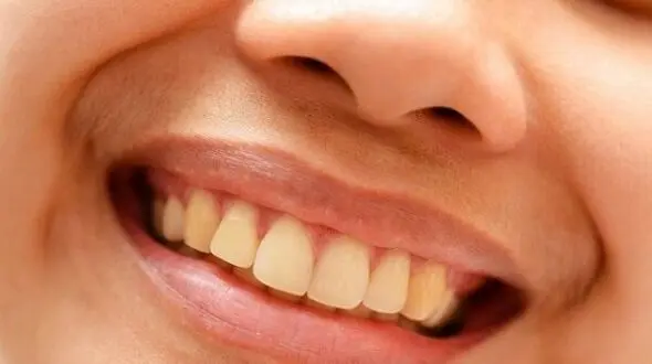 راز جلوگیری از دندان‌درد؛ عادت‌های سالم دندان‌پزشکی
