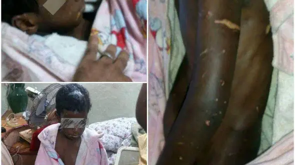 انتشار تلخ ترین عکس از کودک شکنجه شده در بوشهر / به کدامین گناه + جزییات