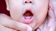 خطر پوسیدگی‌ دندان در پسربچه ها بیشتر است یا دخترها؟ 