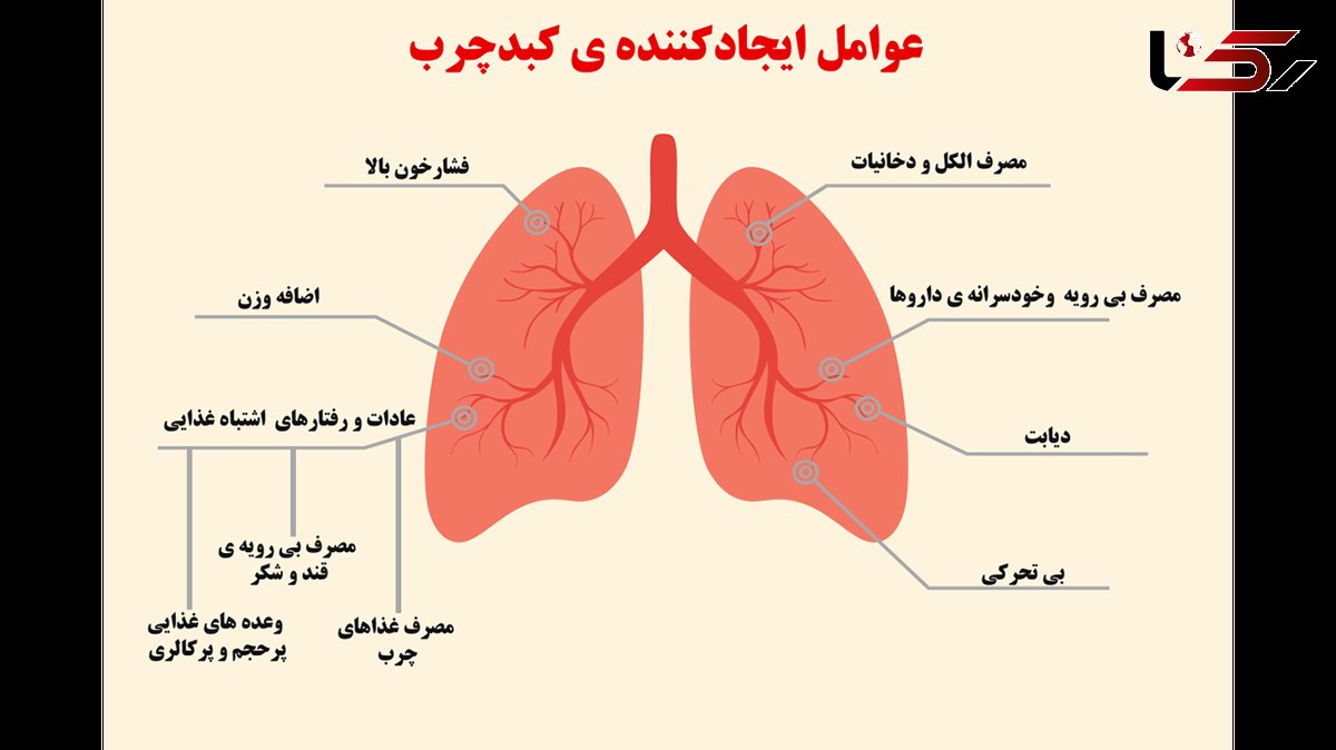 راز درمان کبد چرب 