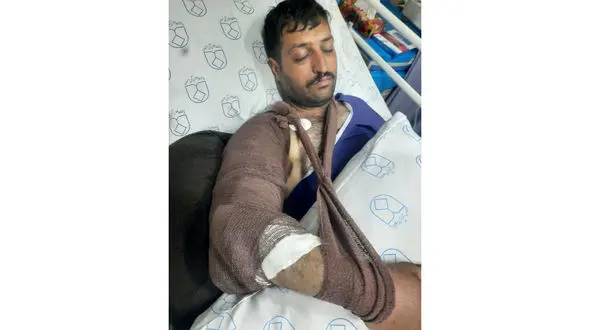 جراحت محیط‌بان اصفهانی با شلیک مستقیم شکارچی غیرمجاز