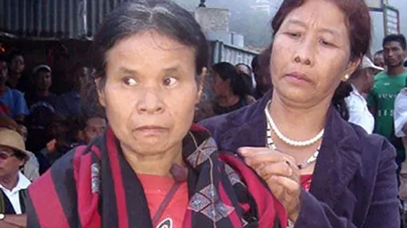 دختری که 38 سال توسط حیوانات وحشی جنگل بزرگ شده این ریخت و قیافه ای پیدا شد/ عکس