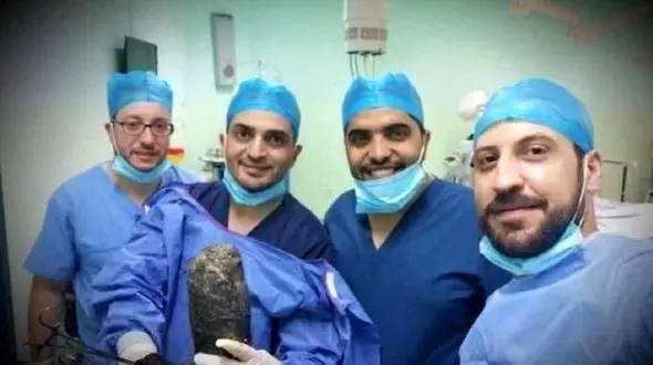 راز غده عجیب در شکم دختر مجرد فاش شد ! / همه شوکه شدند + عکس