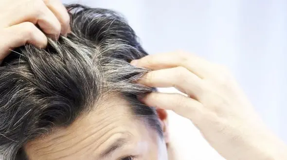 چرا موها در سن پایین سفید می شوند