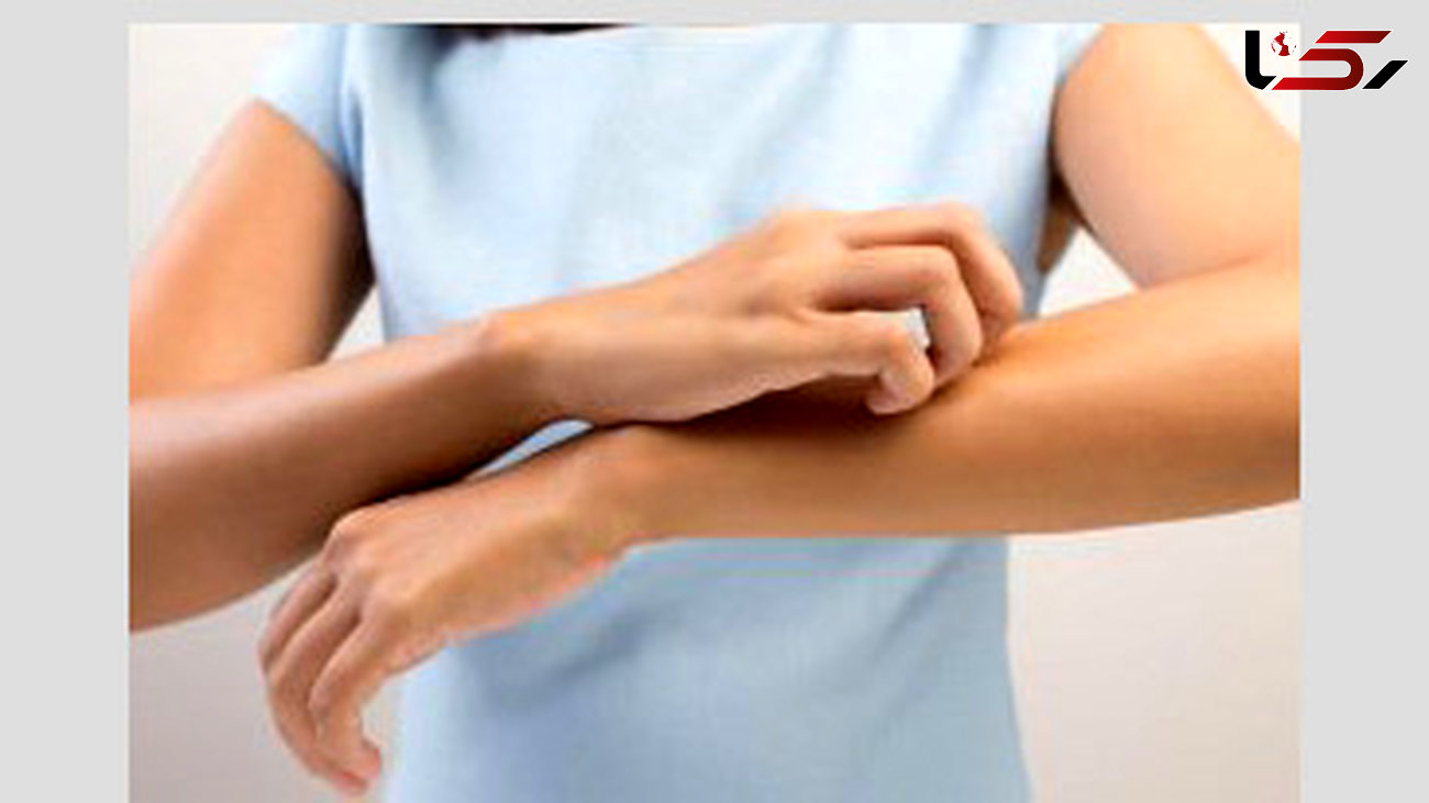 خشکی پوست و احتمال ابتلا به 4 بیماری مهم و خطرناک