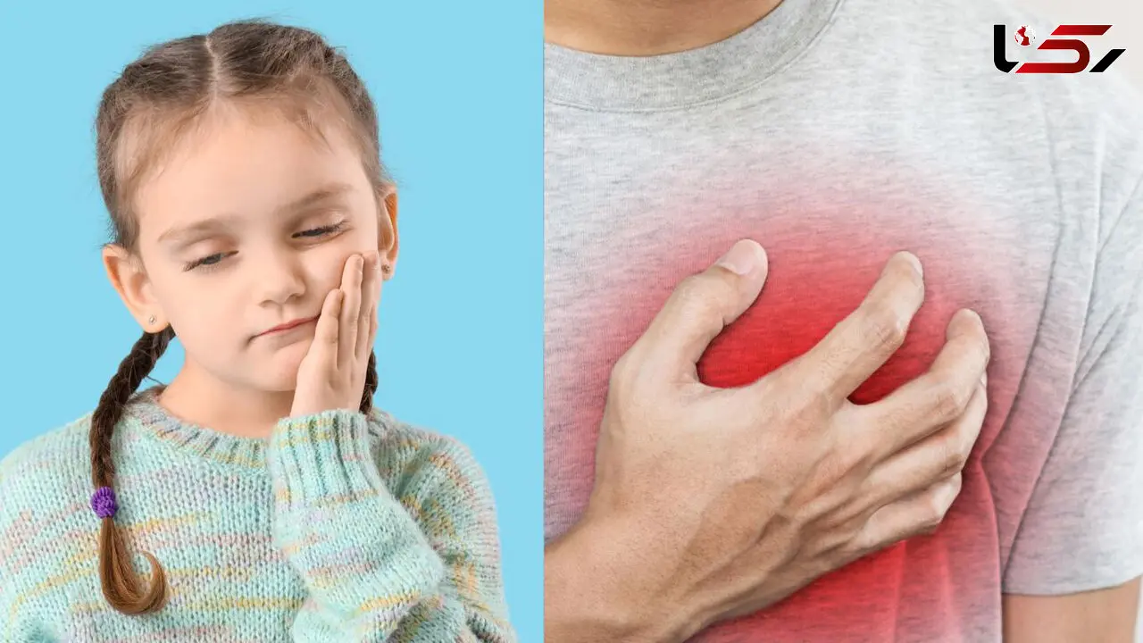 پوسیدگی دندان در کودکی؛ زنگ خطر سلامت قلب در آینده