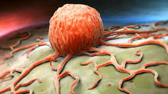 مبارزه با هر سرطانی ممکن شد