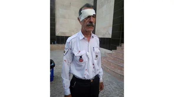 حمله خونین همراهان یک بیمار به اورژانس سرپل ذهاب / بینی تکنسین سرپل ذهاب را شکستند + عکس