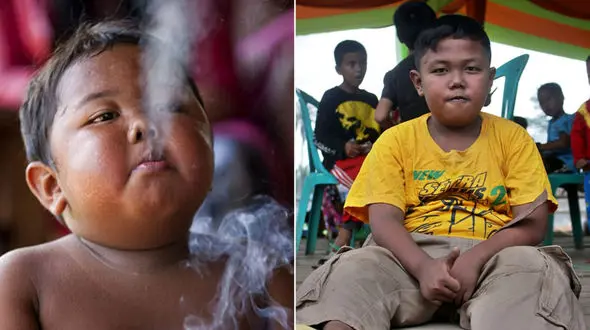 این پسر بچه  روزی 40 نخ سیگارمی کشید  و حالا ترک کرده است + عکس های تکاندهنده اما بامزه