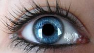 نشانه های آب سیاه چشم را جدی بگیرید