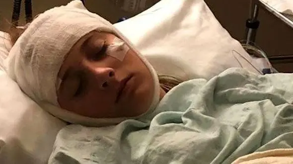 پاک شدن ۲ ساعت یکبار مغز دختر جوان! / بعد از تصادف رخ داد + عکس / امریکا