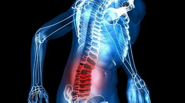  کاهش درد سیاتیک با ساده ترین ترفندها