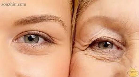 این زن خیلی جوان 70 ساله است ! + عکس حیرت آور بدون جراحی زیبایی