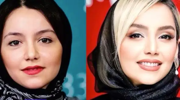 تغییرات چهره نازنین بیاتی از گذشته تا امروز/ ستاره محبوب دقیقا چه جراحی‌هایی انجام داده؟