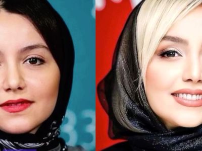 تغییرات چهره نازنین بیاتی از گذشته تا امروز/ ستاره محبوب دقیقا چه جراحی‌هایی انجام داده؟
