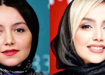تغییرات چهره نازنین بیاتی از گذشته تا امروز/ ستاره محبوب دقیقا چه جراحی‌هایی انجام داده؟