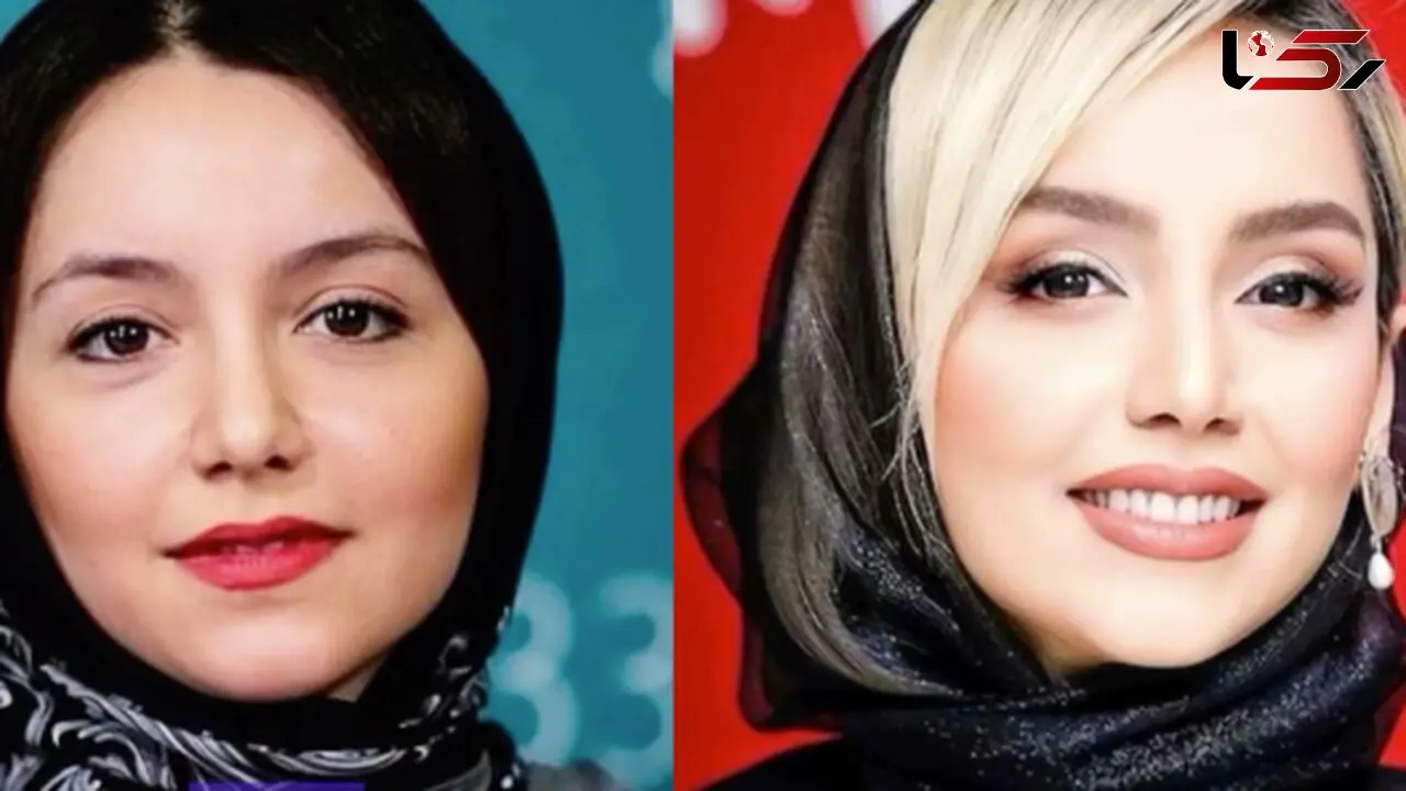 تغییرات چهره نازنین بیاتی از گذشته تا امروز/ ستاره محبوب دقیقا چه جراحی‌هایی انجام داده؟