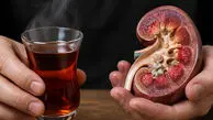 چای پررنگ از عوامل مهم در تشکیل سنگ کلیه 