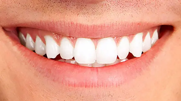 نشانه‌ های کاهش بهداشت دهان و دندان‌ / امیدواری به زندگی با سلامت دهان