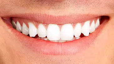 نشانه‌ های کاهش بهداشت دهان و دندان‌ / امیدواری به زندگی با سلامت دهان