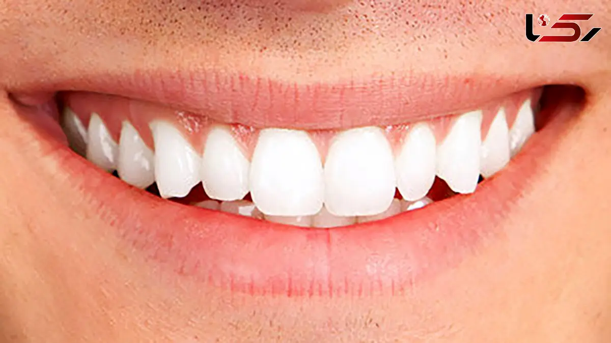 نشانه‌ های کاهش بهداشت دهان و دندان‌ / امیدواری به زندگی با سلامت دهان