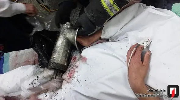 انگشتان کارگر جوان کبابی در میان چرخ گوشت بود+ تصاویر