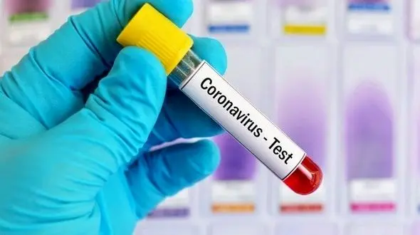 به نتیجه منفی آزمایش کرونا اعتماد نکنید