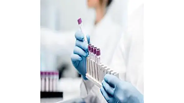  سندرم ولفرام چیست ؟ + راه درمان