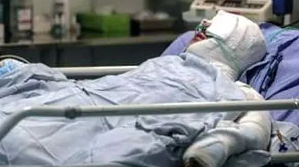 مرد تهرانی زنش را با اسید سوزاند تا طلاق نگیرد! / فریبا فریاد می زد سوختم سوختم!