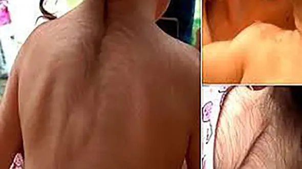 بلایی عجیب که بر اثر اشتباه پزشکان سر کودکان آمد! +عکس