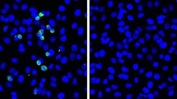 کشف روشی برای محافظت در برابر کرونا
